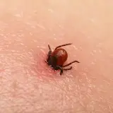 Objawy kleszczowego zapalenia opon mózgowych - nie przegap ich!