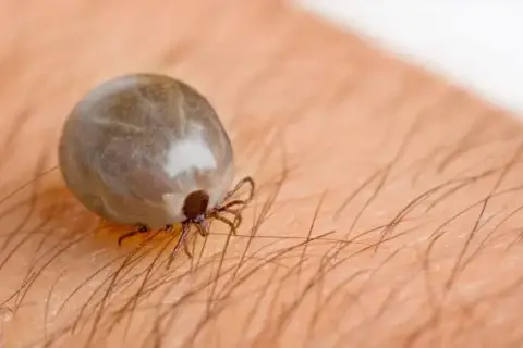 W którą stronę wykręcić kleszcza? Kluczowe wskazówki na pewno pomogą